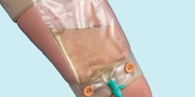 خرید کیسه ادرار متصل به پا و فروش تخصصی انواع کیسه ادرار پایی (۵۰۰ و ۷۵۰ سی‌سی) و خرید کیسه ادرار متصل به پا (یورین بگ) و تضمین قیمت و کیفیت با برندهای معتبر ایرانی و خارجی و ارسال فوری و محرمانه و با بسته‌بندی استاندارد به سراسر کشور.